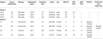 Differences in Vestibular-Evoked Myogenic Potential Responses by Using Cochlear Implant and Otolith Organ Direct Stimulation